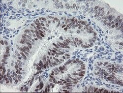 TLE1 Monoclonal Antibody (OTI2D8), TrueMAB , OriGene 100 &mu;L; Unconjugated:Antibodies,