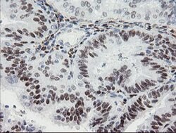 TLE1 Monoclonal Antibody (OTI3C9), TrueMAB , OriGene 100 &mu;L; Unconjugated:Antibodies,