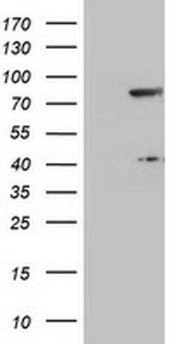 TLE1 Monoclonal Antibody (OTI4F4), TrueMAB , OriGene 30 &mu;L | Buy Online | Origene Technologies | Fisher Scientific