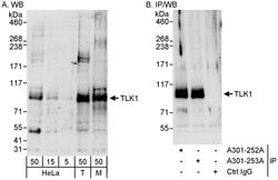 TLK1 Rabbit anti-Human, Mouse, Polyclonal, Bethyl Laboratories 100 &mu;L;