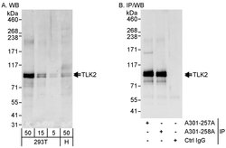 TLK2 Rabbit anti-Human, Polyclonal, Bethyl Laboratories 100 &mu;L; Unconjugated:Antibodies,