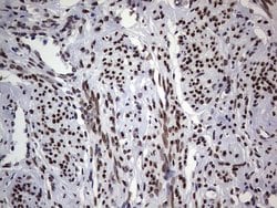 TLK2 Mouse anti-Human, Clone: OTI2G1, lyophilized, TrueMAB 100 &mu;g; Unconjugated:Antibodies,