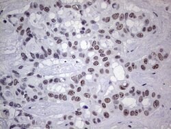 TLK2 Monoclonal Antibody (OTI2C1), TrueMAB , OriGene 30 &mu;L; Unconjugated:Antibodies,