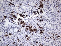 TLK2 Mouse anti-Human, Clone: OTI2F9, liquid, TrueMAB 100 &mu;L; Unconjugated:Antibodies,