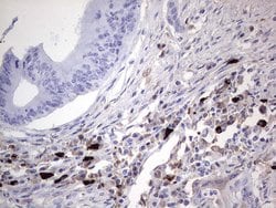 TLK2 Mouse anti-Human, Clone: OTI2F9, liquid, TrueMAB 100 &mu;L; Unconjugated:Antibodies,