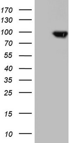 TLK2 Mouse anti-Human, Clone: OTI2G1, lyophilized, TrueMAB 100 &mu;g; Unconjugated:Antibodies,