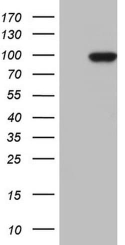 TLK2 Mouse anti-Human, Clone: OTI2F9, liquid, TrueMAB 100 &mu;L; Unconjugated:Antibodies,