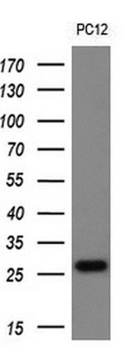 TMED1 Mouse anti-Human, Clone: OTI7D2, lyophilized, TrueMAB 100 &mu;g;
