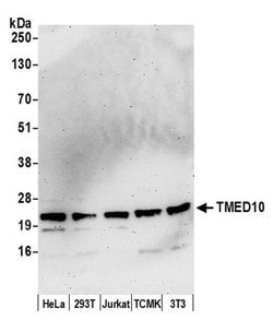 TMED10/TMP21 Polyclonal Antibody, Bethyl Laboratories 20 &mu;L | Buy Online | Bethyl Laboratories, Inc | Fisher Scientific