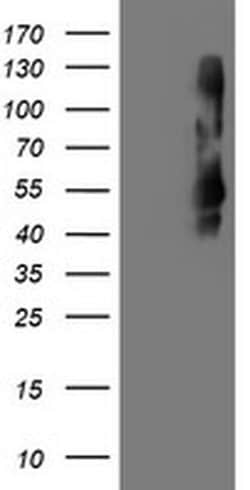TMEFF2 Mouse anti-Human, Clone: OTI1B4, liquid, TrueMAB 100 &mu;L; Unconjugated:Antibodies,