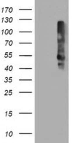 TMEFF2 Mouse anti-Human, Clone: OTI1F9, lyophilized, TrueMAB 100 &mu;g;