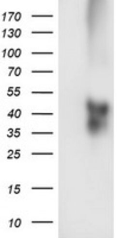 TMEFF2 Mouse anti-Human, Clone: OTI4G2, lyophilized, TrueMAB 100 &mu;g | Buy Online | OriGene | Fisher Scientific