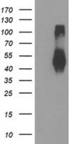 TMEFF2 Mouse anti-Human, Clone: OTI1E4, lyophilized, TrueMAB 100 &mu;g;