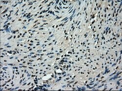 TMEM100 Mouse anti-Human, Clone: OTI2D3, lyophilized, TrueMAB 100 &mu;g;