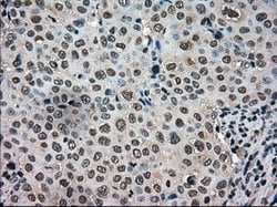 TMEM100 Mouse anti-Human, Clone: OTI2D3, lyophilized, TrueMAB 100 &mu;g;