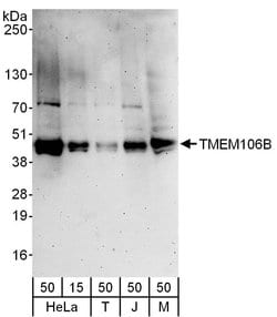 TMEM106B Rabbit anti-Human, Mouse, Polyclonal, Bethyl Laboratories 100