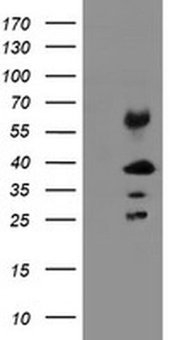 TMEM173 Monoclonal Antibody (OTI1G5), TrueMAB , OriGene 30 &mu;L; Unconjugated:Antibodies,