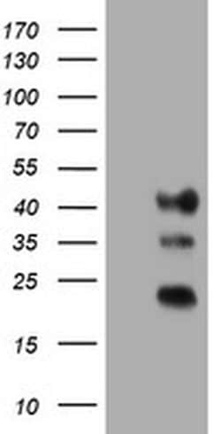 TMEM173 Monoclonal Antibody (OTI2C8), TrueMAB , OriGene 100 &mu;L; Unconjugated:Antibodies,