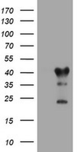 TMEM173 Monoclonal Antibody (OTI4A7), TrueMAB , OriGene 100 &mu;L; Unconjugated:Antibodies,