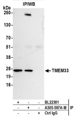 TMEM33 Polyclonal Antibody, Bethyl Laboratories 20 &mu;l; Unlabeled | Buy Online | Bethyl Laboratories, Inc | Fisher Scientific