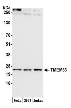 TMEM33 Polyclonal Antibody, Bethyl Laboratories 20 &mu;l; Unlabeled | Buy Online | Bethyl Laboratories, Inc | Fisher Scientific