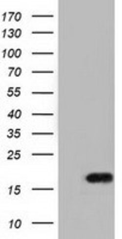 TMEM80 Mouse anti-Human, Clone: OTI2B7, lyophilized, TrueMAB 100 &mu;g;