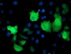 TMOD1 Monoclonal Antibody (OTI6D3), TrueMAB , OriGene:Antibodies:Primary