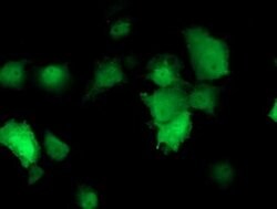 TMOD1 Monoclonal Antibody (OTI3B12), TrueMAB , OriGene 100 &mu;L; Unconjugated:Antibodies,