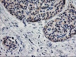 TMOD1 Monoclonal Antibody (OTI1F2), TrueMAB , OriGene 30 &mu;L; Unconjugated:Antibodies,