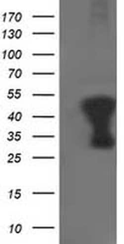 TMOD1 Monoclonal Antibody (OTI1F2), TrueMAB , OriGene 30 &mu;L; Unconjugated:Antibodies,