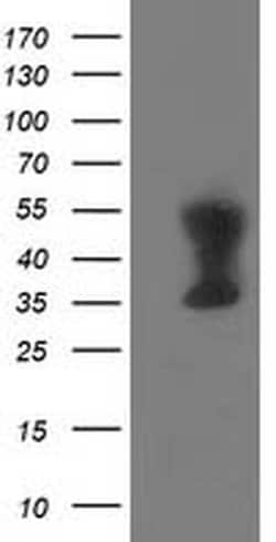 TMOD1 Monoclonal Antibody (OTI7H3), TrueMAB , OriGene 30 &mu;L; Unconjugated:Antibodies,
