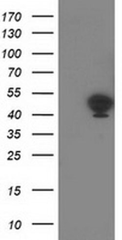 TMOD1 Monoclonal Antibody (OTI5F8), TrueMAB , OriGene:Antibodies:Primary