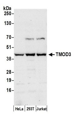 TMOD3 Polyclonal Antibody, Bethyl Laboratories 20 &mu;L; Unconjugated:Antibodies,