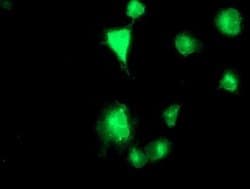 TMPRSS5 Monoclonal Antibody (OTI6E11), TrueMAB , OriGene:Antibodies:Primary
