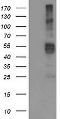TMPRSS5 Monoclonal Antibody (OTI6E11), TrueMAB , OriGene 100 &mu;L; Unconjugated:Antibodies,