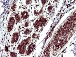 TMX1 Monoclonal Antibody (OTI1G1), TrueMAB , OriGene 100 &mu;L; Unconjugated:Antibodies,