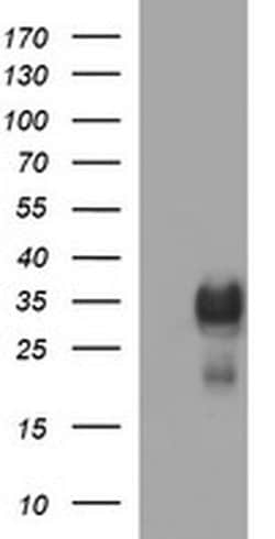 TMX1 Monoclonal Antibody (OTI1A4), TrueMAB , OriGene:Antibodies:Primary