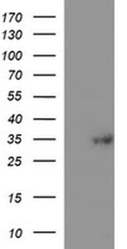 TMX1 Monoclonal Antibody (OTI1G1), TrueMAB , OriGene 100 &mu;L; Unconjugated:Antibodies,