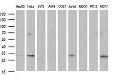 TMX1 Monoclonal Antibody (OTI1G1), TrueMAB , OriGene 100 &mu;L; Unconjugated:Antibodies,