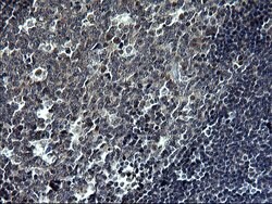 TNFA Monoclonal Antibody (OTI1D9), TrueMAB , OriGene:Antibodies:Primary