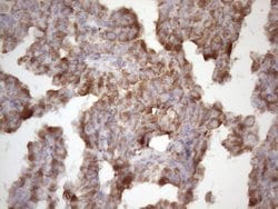 TNFA Monoclonal Antibody (OTI5H8), TrueMAB , OriGene 100 &mu;L; Unconjugated:Antibodies,