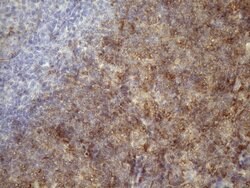 TNFA Monoclonal Antibody (OTI5H8), TrueMAB , OriGene 100 &mu;L; Unconjugated:Antibodies,
