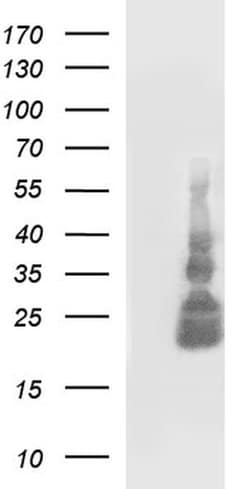 TNFA Monoclonal Antibody (OTI1D9), TrueMAB , OriGene:Antibodies:Primary