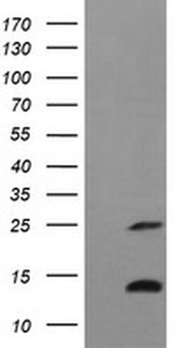 TNFA Monoclonal Antibody (OTI1H3), TrueMAB , OriGene 100 &mu;L; Unconjugated:Antibodies,