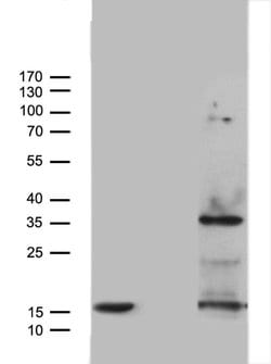 TNFA Monoclonal Antibody (OTI5A11), TrueMAB , OriGene 30 &mu;L; Unconjugated:Antibodies,