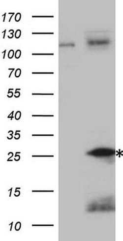 TNFA Monoclonal Antibody (OTI5H8), TrueMAB , OriGene:Antibodies:Primary