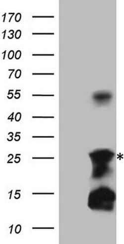 TNFA Monoclonal Antibody (OTI4B9), TrueMAB , OriGene 100 &mu;L; Unconjugated:Antibodies,