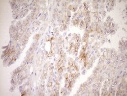 TNFRSF10B Monoclonal Antibody (OTI4B12), TrueMAB , OriGene:Antibodies:Primary