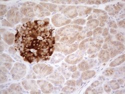 TNFRSF10B Mouse anti-Human, Mouse, Clone: OTI2A5, liquid, TrueMAB 100 &mu;L;