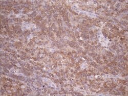 TNFRSF10B Mouse anti-Human, Mouse, Clone: OTI2A5, liquid, TrueMAB 100 &mu;L;
